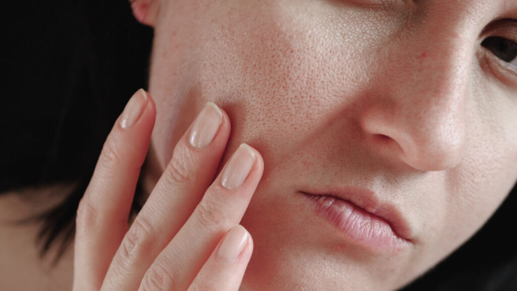 dull skin