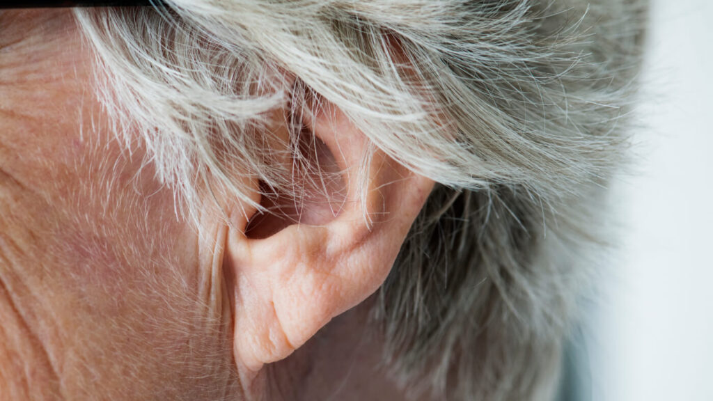 earlobe ageing