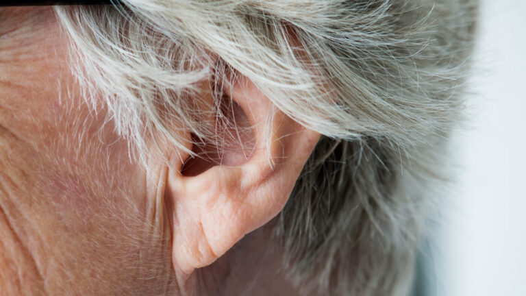 earlobe ageing