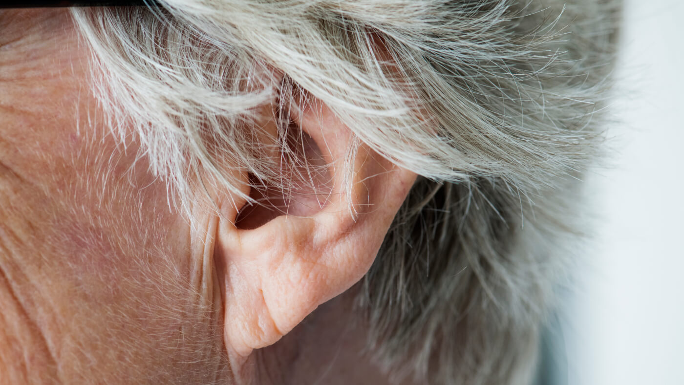 earlobe ageing