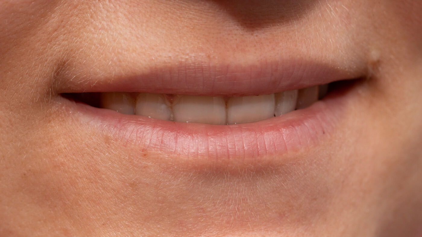 thin lips treatment