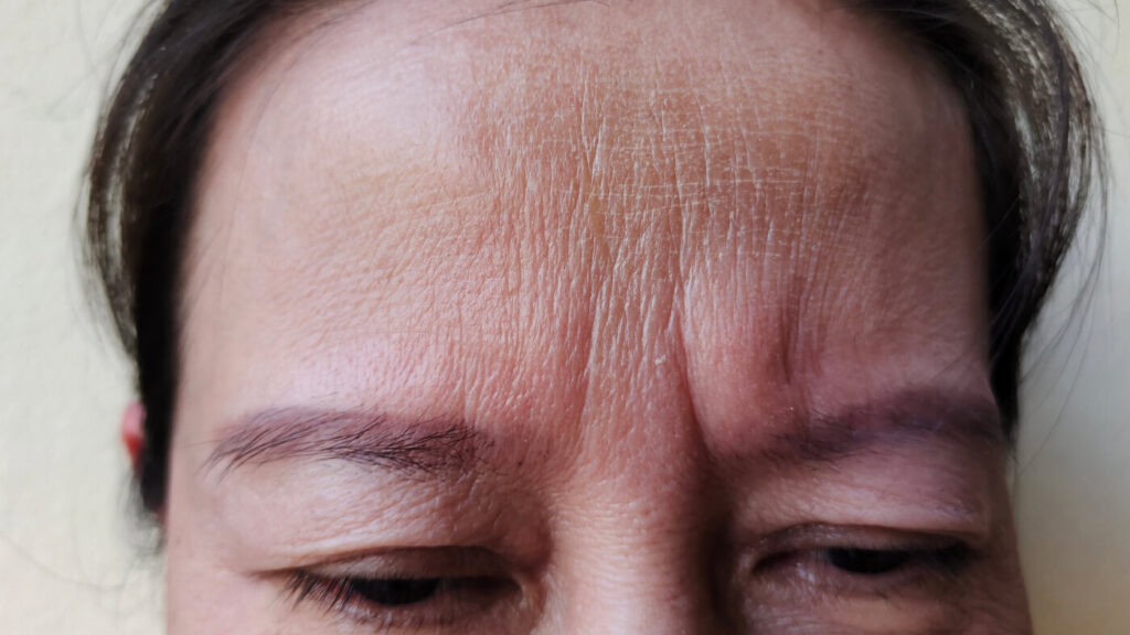 Faces By Bae | London Aesthetics | Award Winning