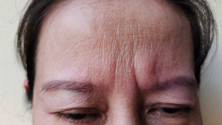 Faces By Bae | London Aesthetics | Award Winning